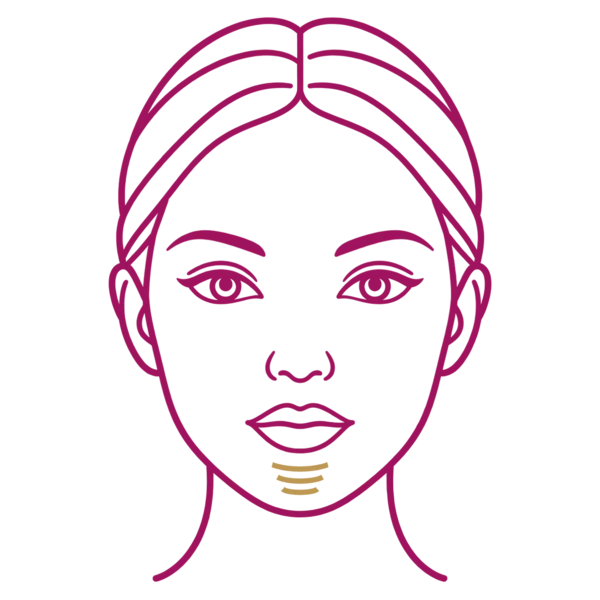 Illustration of a face marking chin wrinkles for Sculptra collagen stimulation in London